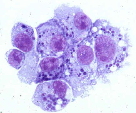 Agentes causales de la anaplasmosis humana (familia Anaplasmataceae)